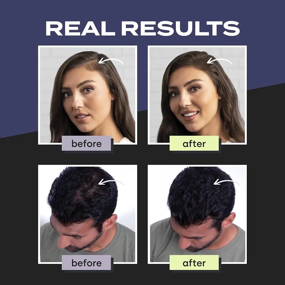 Toppik Hair Building Fibers - Black 27.5 gm with Spray Applicator, Combo Pack